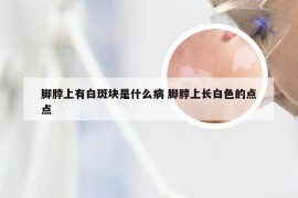 脚脖上有白斑块是什么病 脚脖上长白色的点点