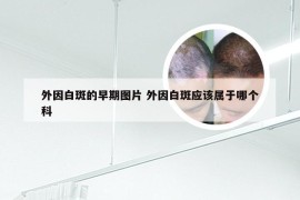 外因白斑的早期图片 外因白斑应该属于哪个科