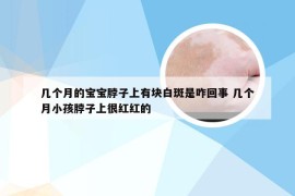 几个月的宝宝脖子上有块白斑是咋回事 几个月小孩脖子上很红红的