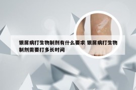 银屑病打生物制剂有什么要求 银屑病打生物制剂需要打多长时间