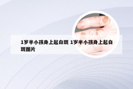 1岁半小孩身上起白斑 1岁半小孩身上起白斑图片