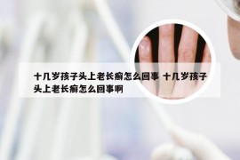 十几岁孩子头上老长癣怎么回事 十几岁孩子头上老长癣怎么回事啊