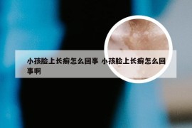 小孩脸上长癣怎么回事 小孩脸上长癣怎么回事啊