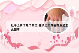 肚子上长了几个白斑 肚子上长白色斑点是怎么回事