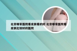 北京哪家医院看皮肤看的好 北京哪家医院看皮肤比较好的医院