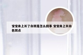 宝宝身上长了白斑是怎么回事 宝宝身上长白色斑点