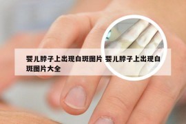 婴儿脖子上出现白斑图片 婴儿脖子上出现白斑图片大全