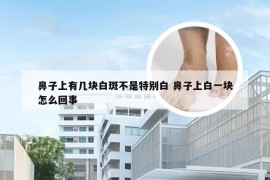 鼻子上有几块白斑不是特别白 鼻子上白一块怎么回事