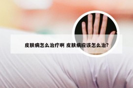 皮肤病怎么治疗啊 皮肤病应该怎么治?