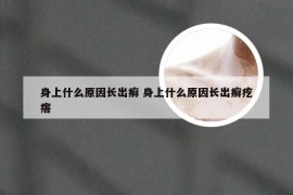 身上什么原因长出癣 身上什么原因长出癣疙瘩