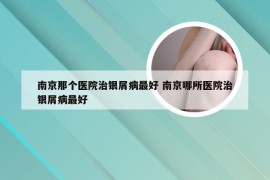 南京那个医院治银屑病最好 南京哪所医院治银屑病最好