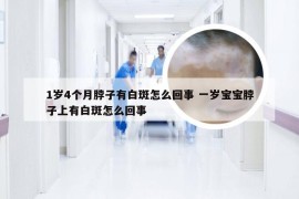 1岁4个月脖子有白斑怎么回事 一岁宝宝脖子上有白斑怎么回事