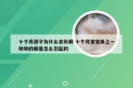 十个月孩子为什么会长癣 十个月宝宝身上一块块的癣是怎么引起的