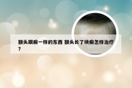 额头跟癣一样的东西 额头长了块癣怎样治疗?