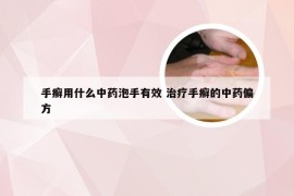 手癣用什么中药泡手有效 治疗手癣的中药偏方