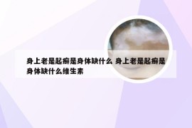 身上老是起癣是身体缺什么 身上老是起癣是身体缺什么维生素