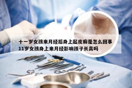 十一岁女孩来月经后身上起皮癣是怎么回事 11岁女孩身上来月经影响孩子长高吗