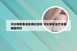 河北哪里看皮肤病比较好 河北哪家治疗皮肤病医院好