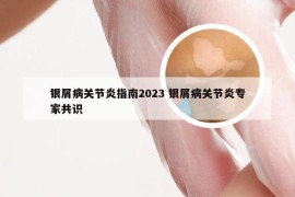 银屑病关节炎指南2023 银屑病关节炎专家共识