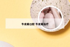 牛皮廨口腔 牛皮廨治疗