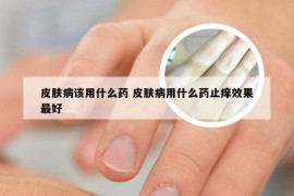 皮肤病该用什么药 皮肤病用什么药止痒效果最好