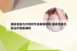 提高免疫力针剂对牛皮癣有效吗 提高免疫力能治疗银屑病吗