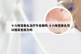 十八味党参丸治疗牛皮癣吗 十八味党参丸可以提高免疫力吗