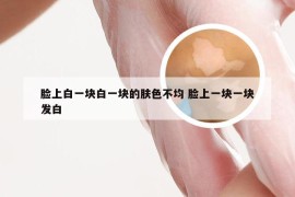 脸上白一块白一块的肤色不均 脸上一块一块发白