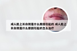 成人脸上长白斑是什么原因引起的 成人脸上长白斑是什么原因引起的怎么治疗