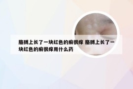 胳膊上长了一块红色的癣很痒 胳膊上长了一块红色的癣很痒用什么药