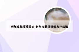 老年皮肤瘙痒偏方 老年皮肤瘙痒偏方扑尔敏