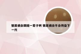 银屑病会跟随一辈子啊 银屑病会不会传染下一代