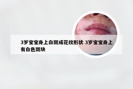 3岁宝宝身上白斑成花纹形状 3岁宝宝身上有白色斑块