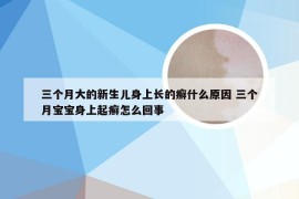 三个月大的新生儿身上长的癣什么原因 三个月宝宝身上起癣怎么回事