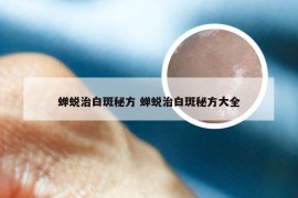 蝉蜕治白斑秘方 蝉蜕治白斑秘方大全