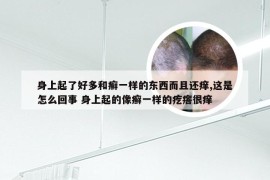 身上起了好多和癣一样的东西而且还痒,这是怎么回事 身上起的像癣一样的疙瘩很痒