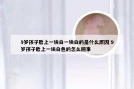 9岁孩子脸上一块白一块白的是什么原因 9岁孩子脸上一块白色的怎么回事