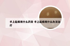 手上起癣用什么药膏 手上起癣用什么办法治疗