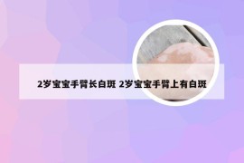 2岁宝宝手臂长白斑 2岁宝宝手臂上有白斑