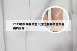 2023银屑病养生堂 北京卫视养生堂银屑病的治疗