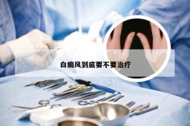 白癜风到底要不要治疗