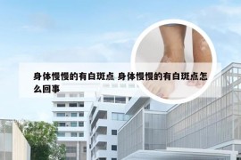 身体慢慢的有白斑点 身体慢慢的有白斑点怎么回事