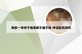 胸前一块块干燥像癣不痛不痒 神话能找回吗