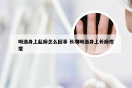 喝酒身上起癣怎么回事 长期喝酒身上长癣疙瘩