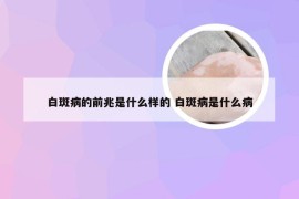 白斑病的前兆是什么样的 白斑病是什么病