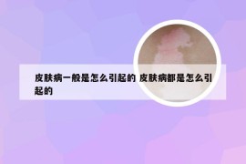 皮肤病一般是怎么引起的 皮肤病都是怎么引起的