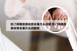 肛门周围皮肤白斑会是什么问题 肛门周围皮肤白斑会是什么问题呢