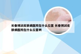 长春博润皮肤病医院在什么位置 长春博润皮肤病医院在什么位置啊