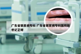 广东省银屑病专科 广东省银屑病专科医院新世纪正规