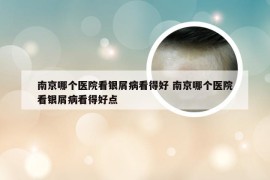 南京哪个医院看银屑病看得好 南京哪个医院看银屑病看得好点